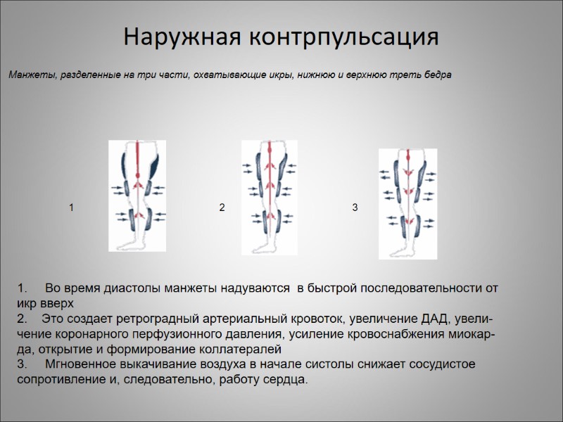 Наружная контрпульсация Во время диастолы манжеты надуваются  в быстрой последовательности от  икр